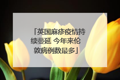 英国麻疹疫情持续蔓延 今年来伦敦病例数最多